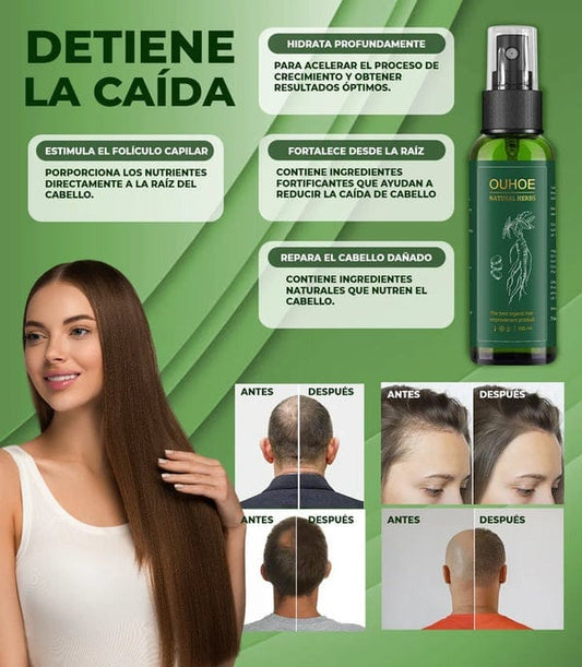 ¡OFERTA 2X1! OUHOE® Haz crecer tu cabello en 21 días